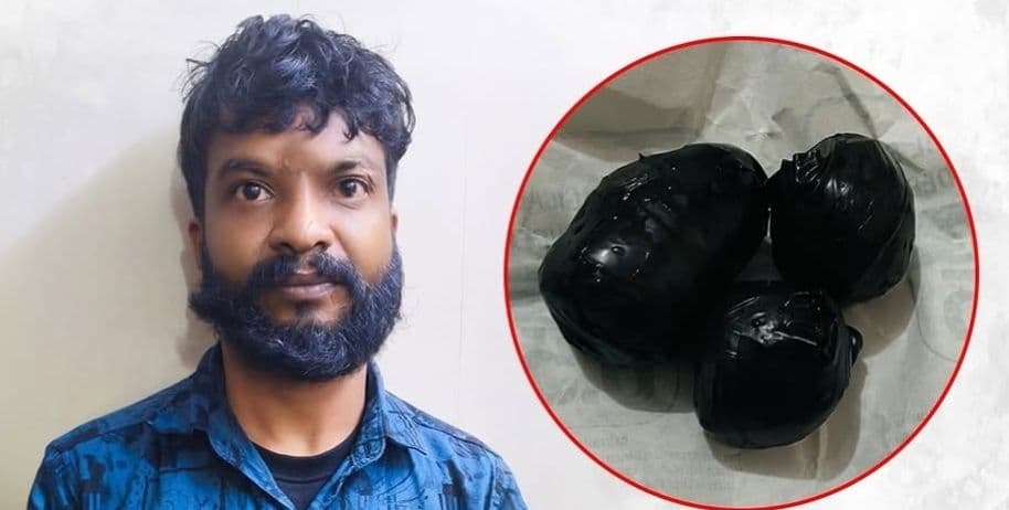 മലദ്വാരത്തിലൊളിപ്പിച്ച് എംഡി എം എ കടത്ത്